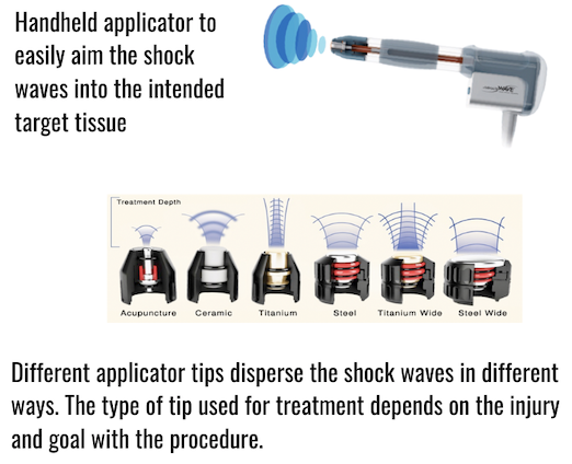 Shockwave Applicator 1 Peak Form Health Center