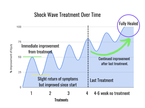 Shockwavehealing Progression Peak Form Health Center