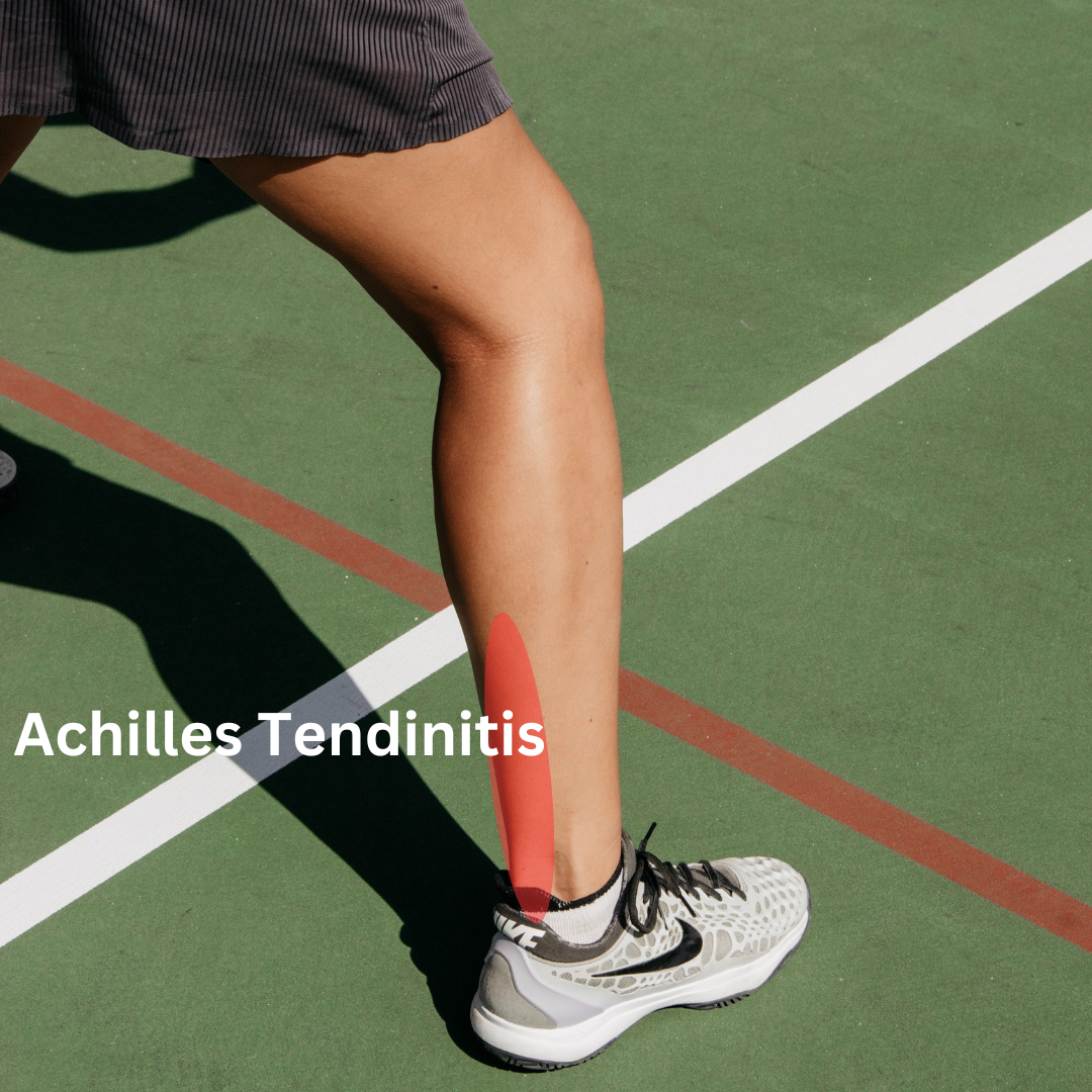 Exercises, Stretches, Achilles Healers Sports Therapy